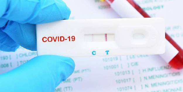 Hızlı Covid-19 testleri, Omicron varyantını tespit edemeyebilir