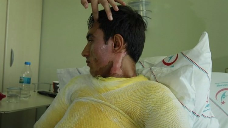 Holiganlar bunu da yaptı! Görevlinin yüzüne...