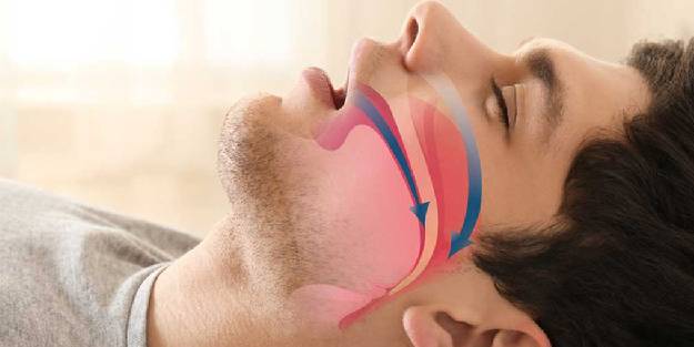 Horlama çözümü: Kaliteli bir yaşam için, kaliteli uyku şart!