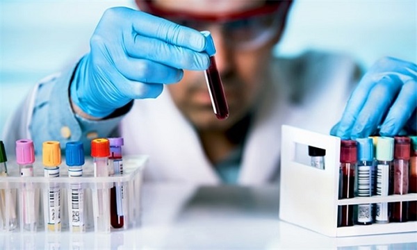 Hormon testi neden ve nerede yapılır?