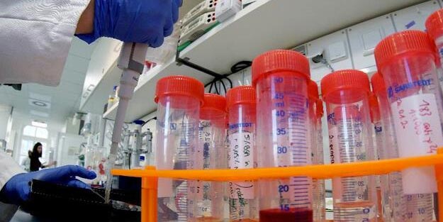 Human corona virüsü nedir? Türkiye’de korona virüs var mı?