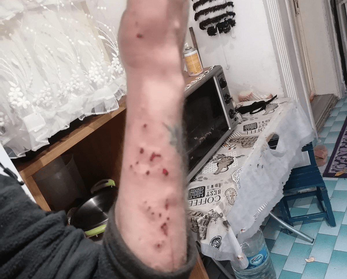 Hurdacının merakı başına bela oldu! Bu hale geldi
