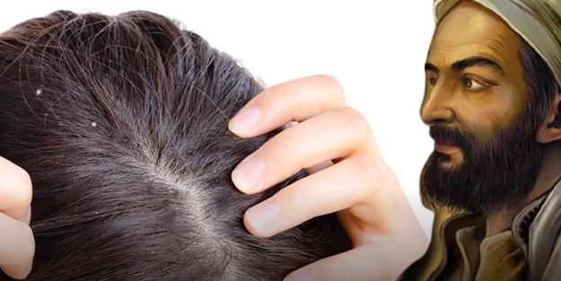 İbn-i Sina önermişti: Saç çıkarma yöntemleri var!