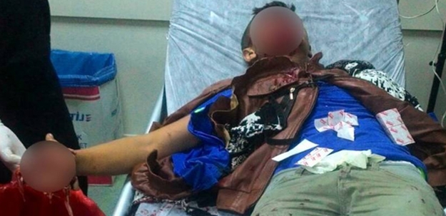 İbretlik olay! Polise atmak istediği bomba...