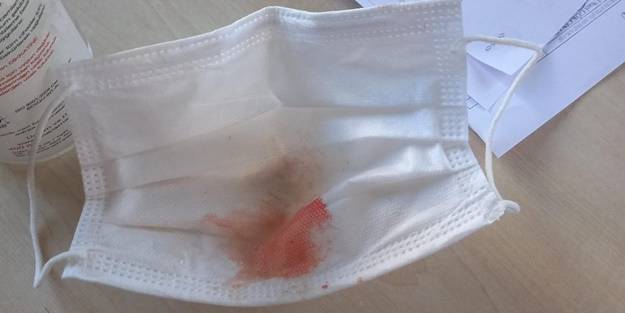 İç burkan görüntü! Doktoru darp etti