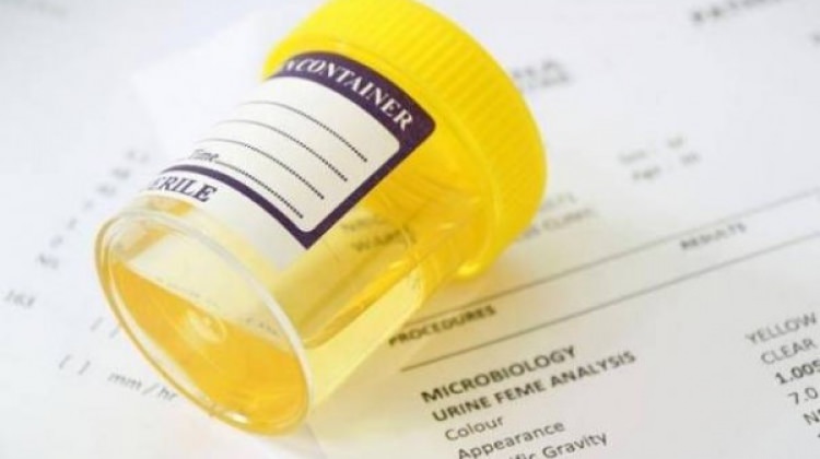 İdrar tahlili beslenmeyi ele verecek