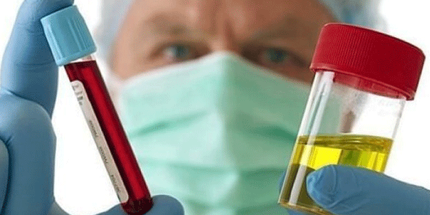 İdrarında kanama olanlar aman dikkat! Bunun belirtisi olabilir