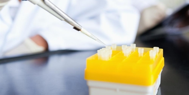 İdrarınızın rengi böyleyse dikkat - FOTO