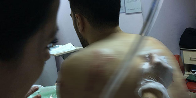 İftara giderken 25'i birden saldırdı!
