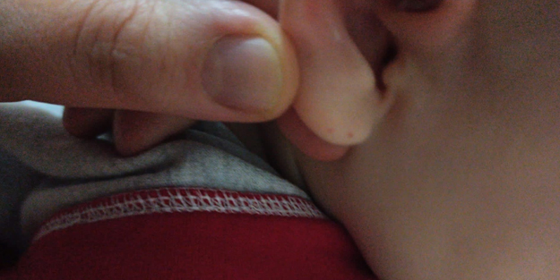 Iğdır'da akılalmaz olay! Eve giren yarasa iki çocuğun kulağını ısırdı