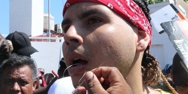 İğne iplikle ağızlarını diktiler! Görülmemiş protesto