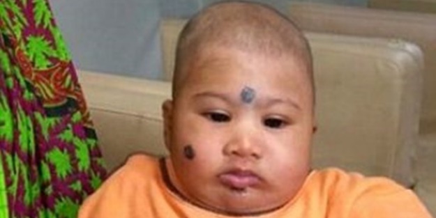 İki başlı bebek hayrete düşürüyor!