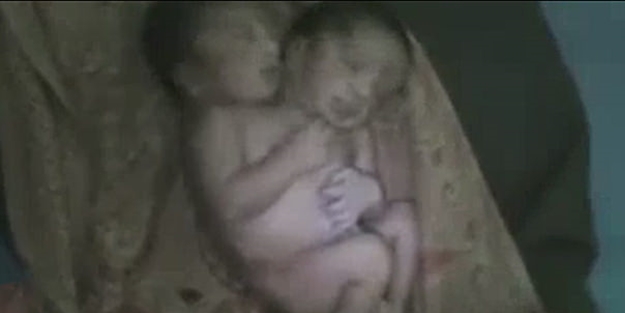 Çift başlı bebek şok etti! VİDEO