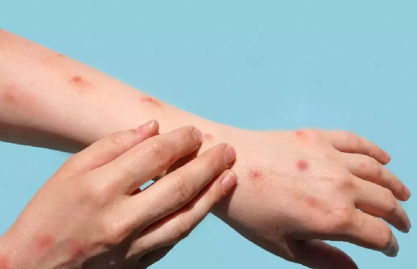 İki kişi karantinaya alındı