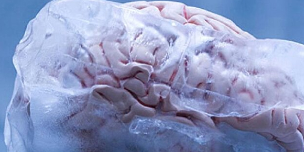 Akademisyenden şaşırtan vasiyet: Beyninin dondurulmasını istedi!