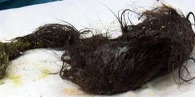 İlginç alışkanlığı başına bela oldu!