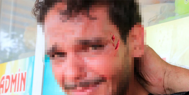 İlginç olay: Köpeğin ısırdığı adama ters kelepçe