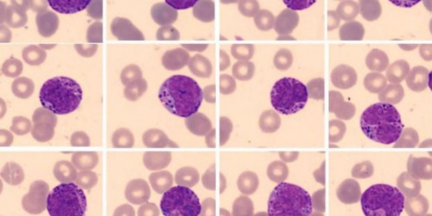 İlik nakli için 30 kişi yola çıktı