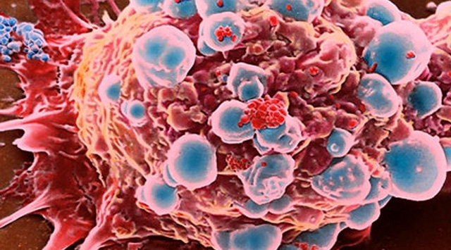 İnanç ve moral kanseri yenmekte önemli rol oynuyor