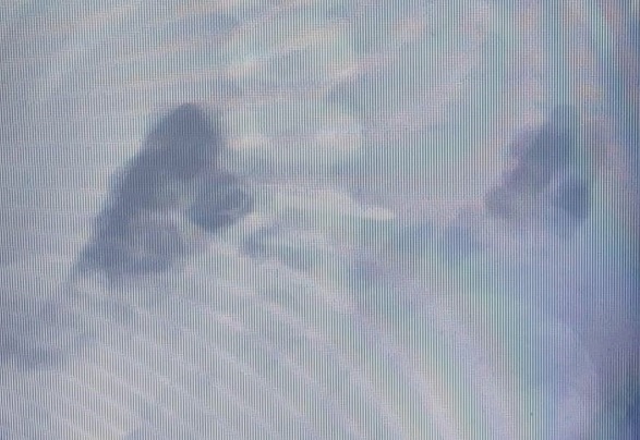 İnanılır gibi değil! Bakın 2 yaşındaki çocuk ne yuttu