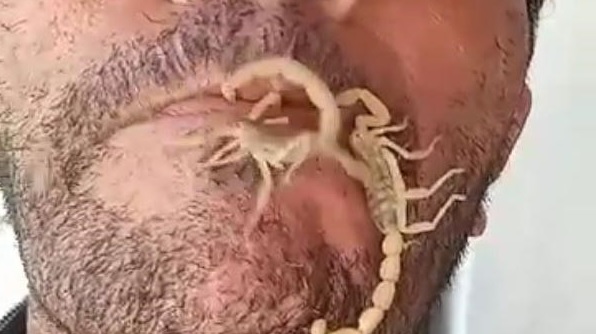 İnanılır gibi değil! Bakın bu adam kendini neden akreplere sokturdu
