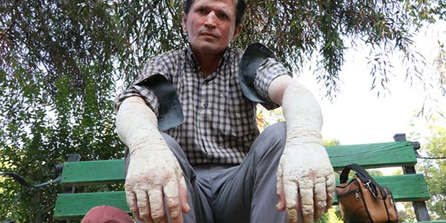 İnanılmaz değişim! Eskiden insanlar ondan kaçıyordu, şimdi ise...