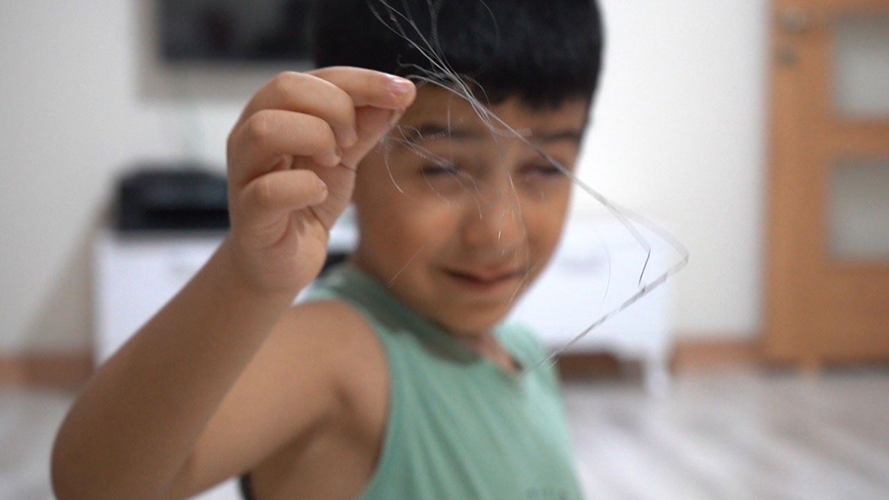 İnanması güç ama gerçek! Küçük bedeninde 3 yıl kateterle yaşadı