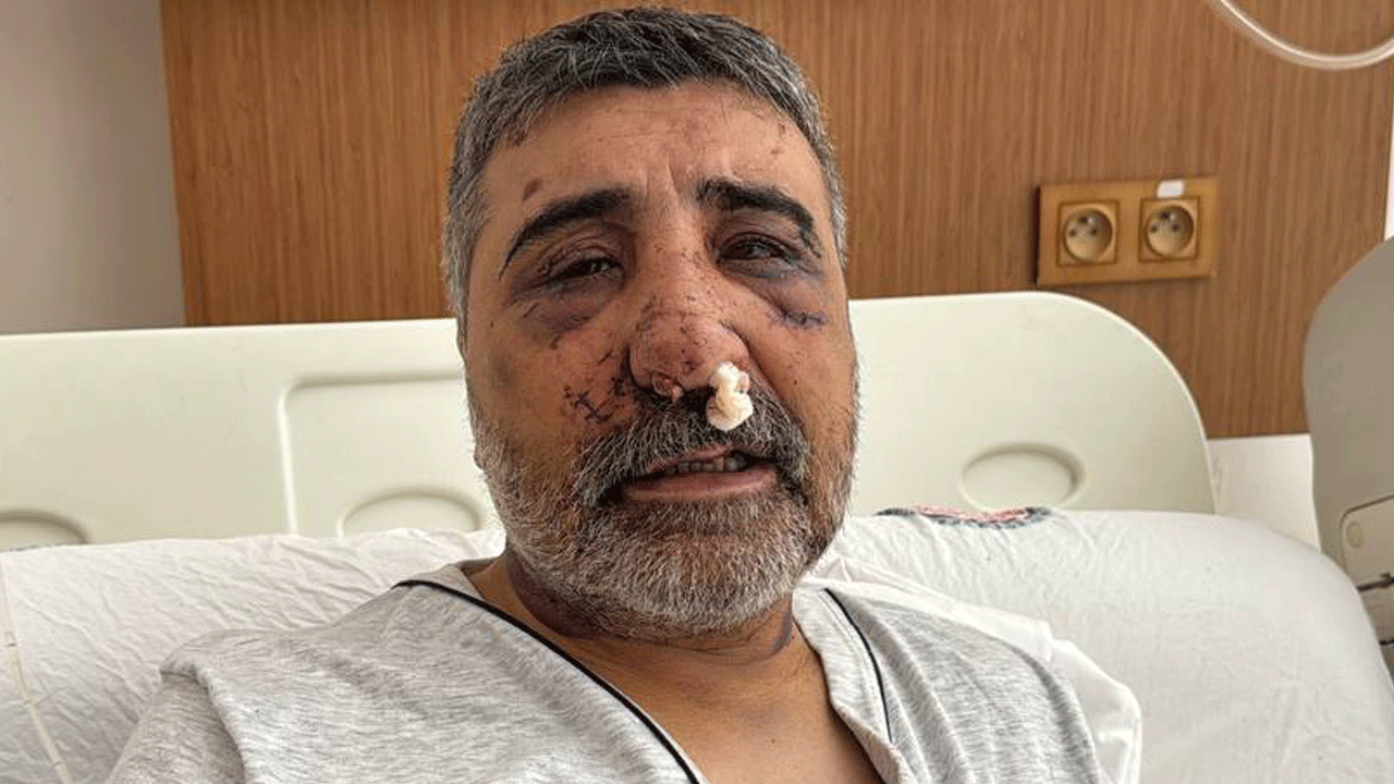 İngiliz boksörün komalık ettiği taksici, yaşadığı dehşeti anlattı: Yüz şeklim değişti