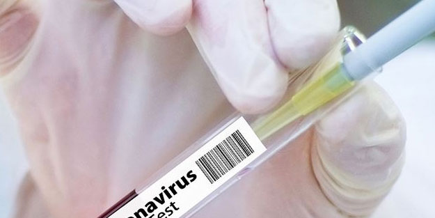 İngiltere'de koronavirüse karşı yeni aşı test edildi