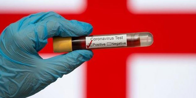 İngiltere'de son 24 saatte koronavirüs nedeniyle 598 kişi öldü