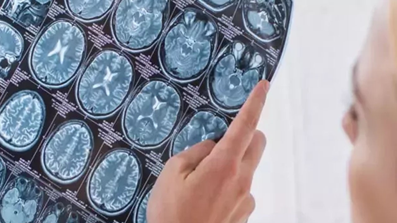 Bu da oldu: Bir kişi, kafatası parçasını midesinde taşıdı