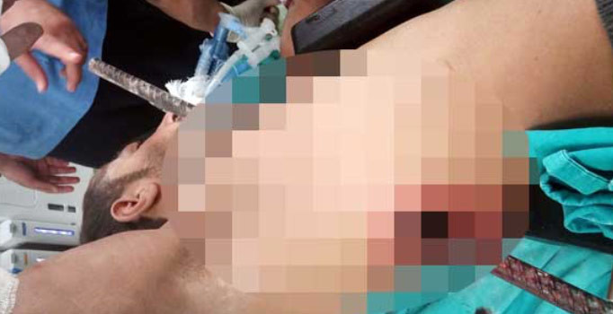 inşaat işçisi dengesini kaybetti demir çubuk göğsünden girdi sırtından çıktı!