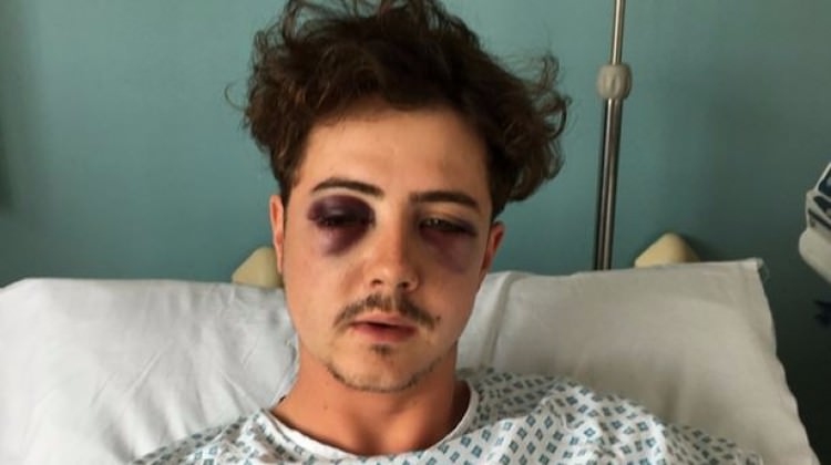 İnsanlık dışı olay! Kafatasını kırdılar