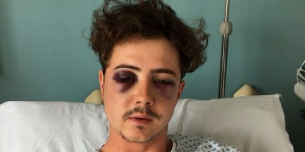 İnsanlık dışı olay! Rakip sanıp kafatasını kırdılar