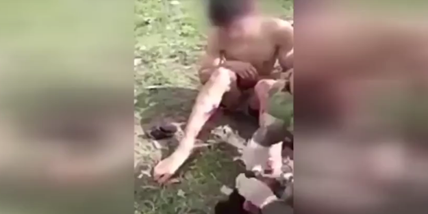 İnsanlık görün! Mehmetçik yaralı teröristi...