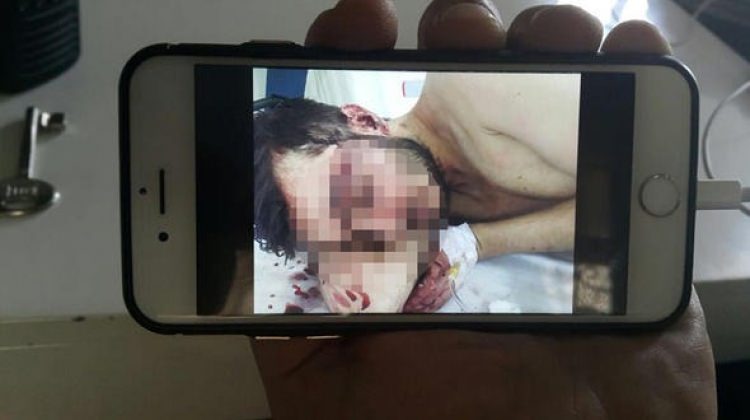 İnternette tanıştı! Evini basıp oklavayla dövdüler