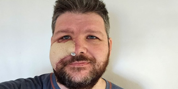 İntikamın böylesi! Yüzünü parçalayan ayıyı kebap yapıp yedi!