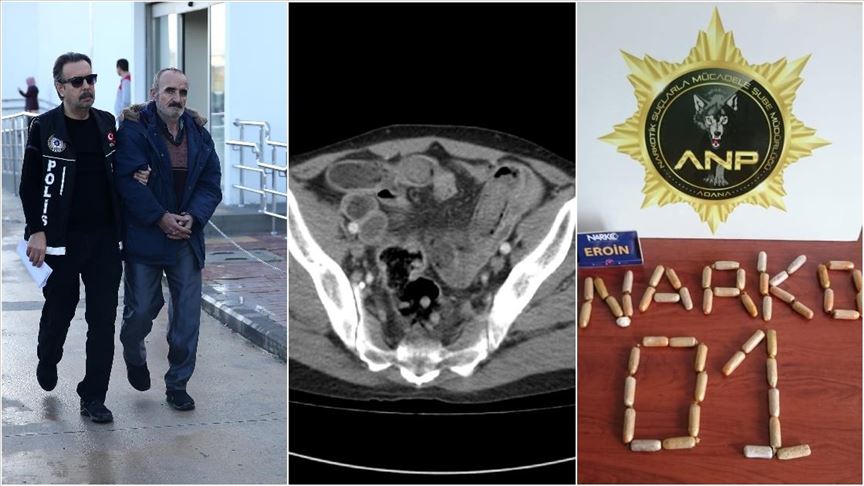 İran'dan Adana'ya midesindeki 775 gram eroinle gelmiş