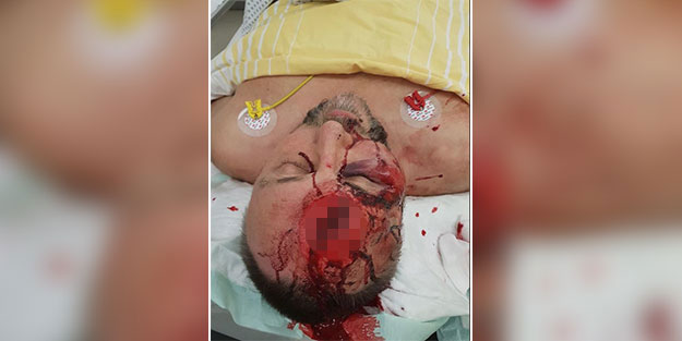 Irkçı vekili öldüresiye dövdüler