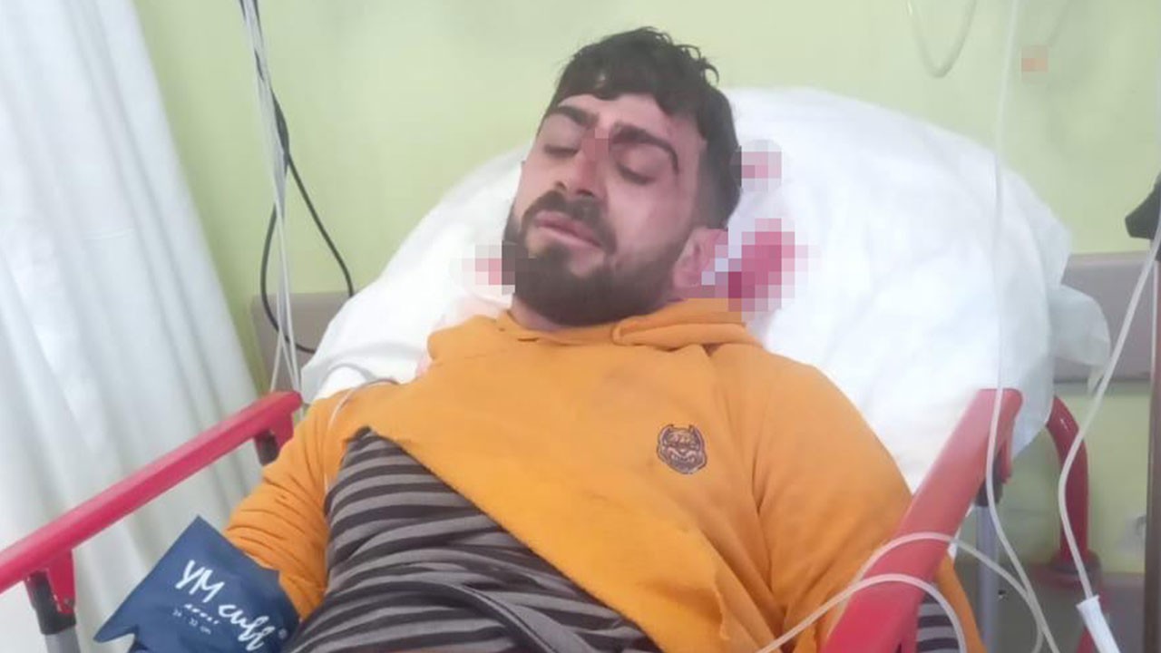 İş kazasında hafızasını kaybetti! Bakın sadece kimi hatırlıyor