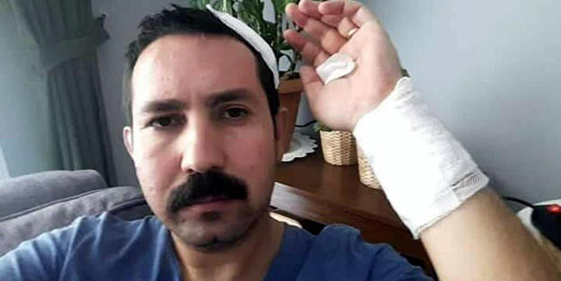 İş yerlerini denetleyen personele beyzbol sopasıyla saldırdılar