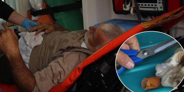 İşçinin kopan parmağı eldivenin içinden çıktı