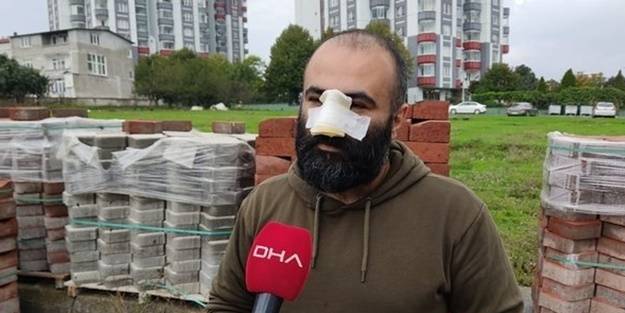 İşe gitmek için evden çıkmıştı! Pitbull burnunu kopardı