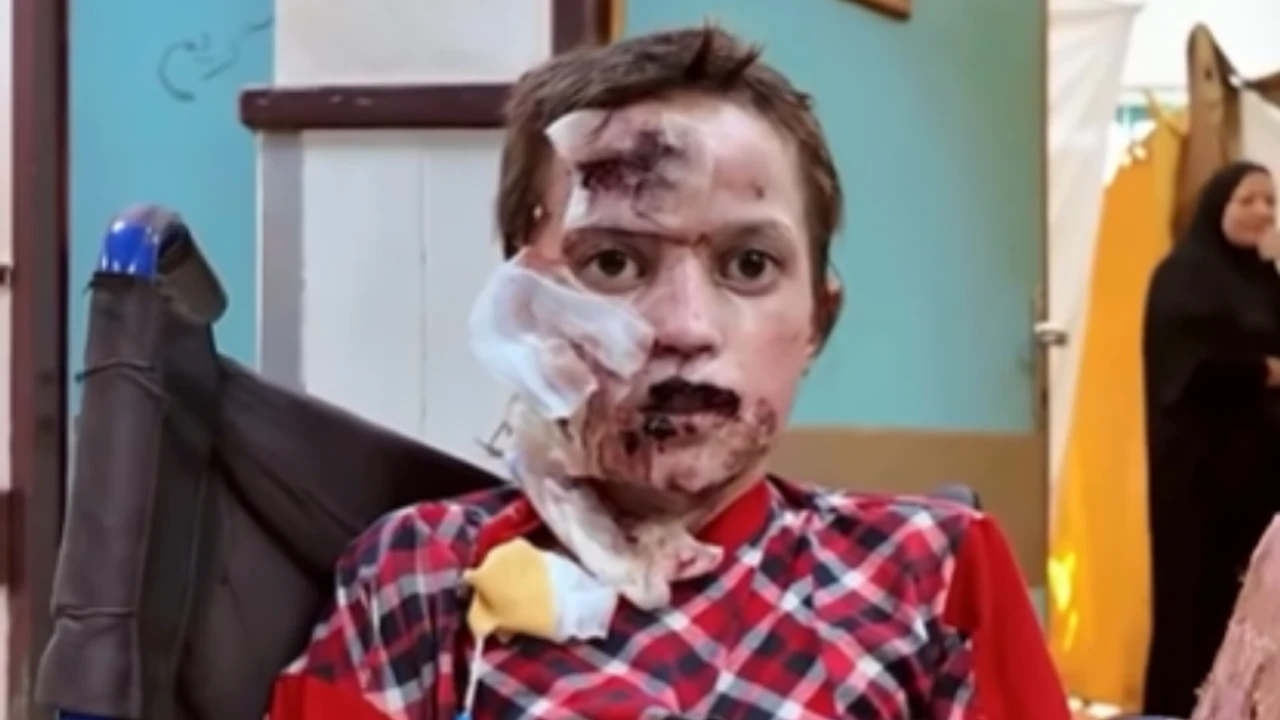 İşgalci İsrail, Gazzeli çocukları yakarak katlediyor!