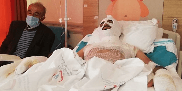 Isınmak için tenekeye tiner dökünce olanlar oldu!