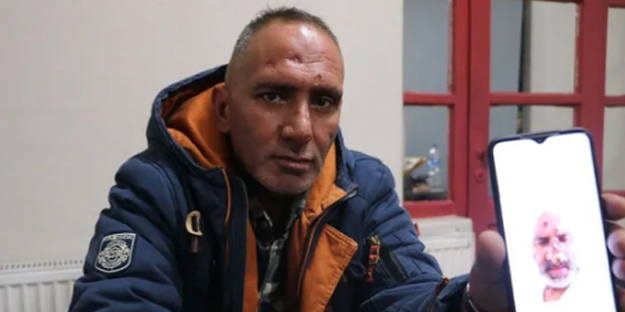 Isıran sinek hayatını kararttı! Tanınmayacak hale geldi tedavi sonrası da...