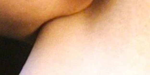 Isırdığı gencin boynundan et kopardı!