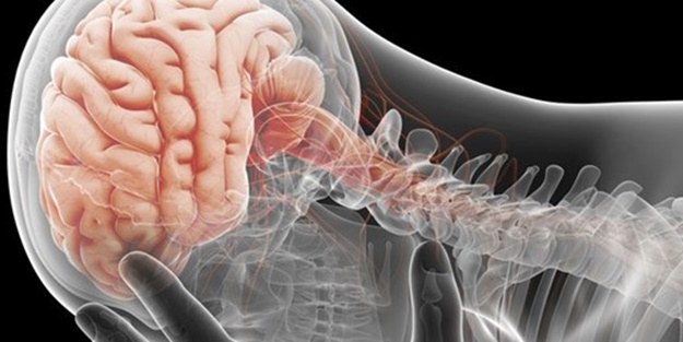  İskemik atak nedir?