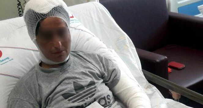 İşkence edilen kadın konuştu!