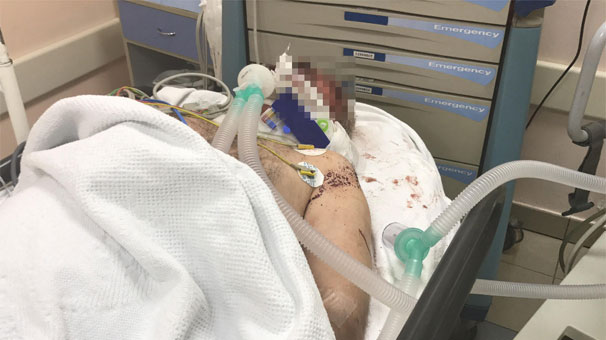 İşkence yapılıp inşaatta ölüme terk edildi